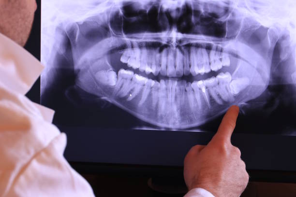 Best Urgent Tooth Repair  in Granite Falls, WA