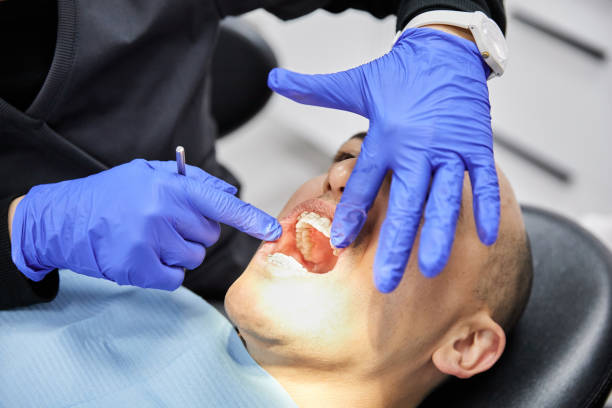 Best Chipped Tooth Repair Near Me  in Granite Falls, WA